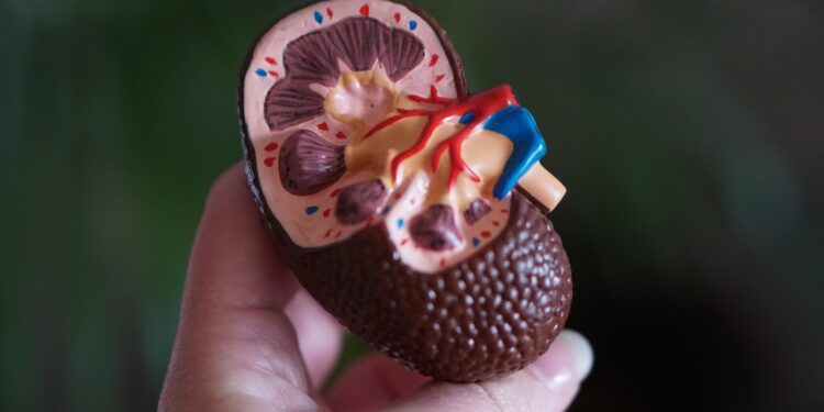 Nierenschmerzen - Wo sitzen die Nieren